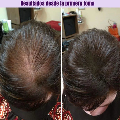 HairGrowth: Suplemento para el crecimiento capilar avanzado